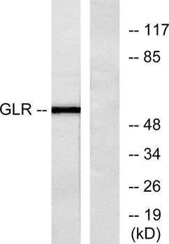 Glucagon Receptor rabbit pAb Antibody
