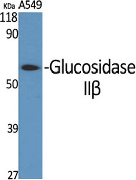 Glucosidase IIβ rabbit pAb