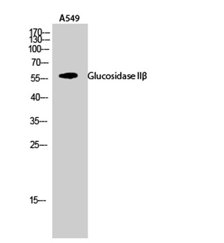 Glucosidase IIβ rabbit pAb