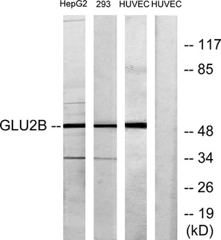 Glucosidase IIβ rabbit pAb