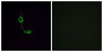 GluR-1 rabbit pAb Antibody