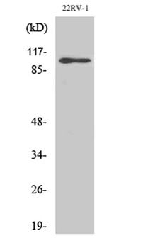 GluR-2 rabbit pAb Antibody