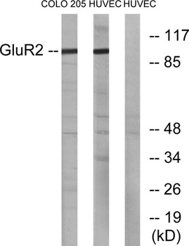 GluR-2 rabbit pAb Antibody