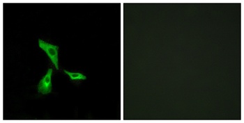 GPR101 rabbit pAb Antibody