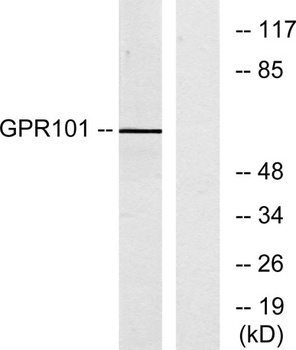 GPR101 rabbit pAb Antibody