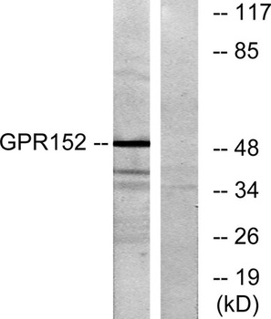 GPR152 rabbit pAb Antibody