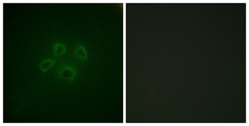GRB10 rabbit pAb Antibody