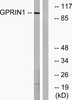 GRIN1 rabbit pAb Antibody