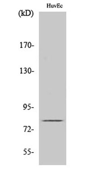 GRK 2 rabbit pAb Antibody