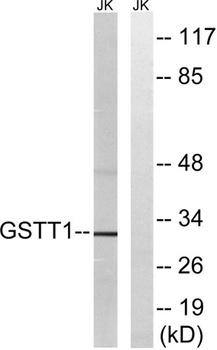 GSTT1/4 rabbit pAb Antibody