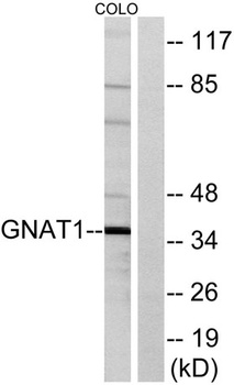 Gα t1 rabbit pAb Antibody