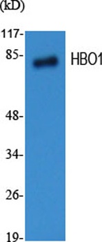 HBO1 rabbit pAb Antibody