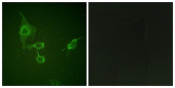 Hck rabbit pAb Antibody