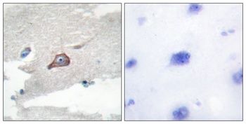 Hck rabbit pAb Antibody