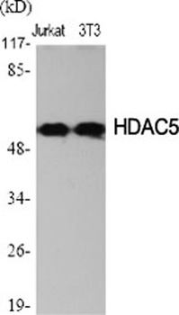 HDAC2 rabbit pAb Antibody