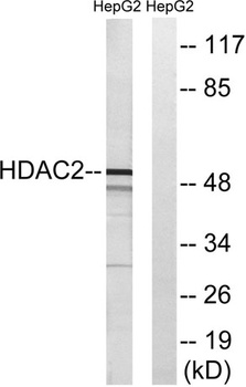 HDAC2 rabbit pAb Antibody