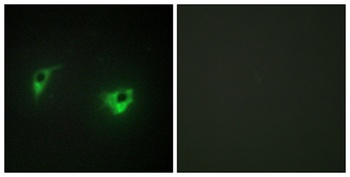 HGK rabbit pAb Antibody
