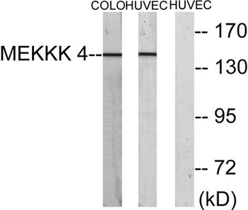 HGK rabbit pAb Antibody