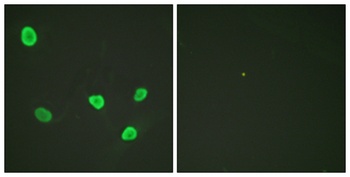 Histone H2B rabbit pAb Antibody