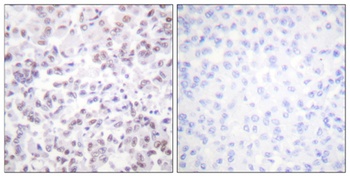 Histone H2B rabbit pAb Antibody
