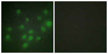 HKR1 rabbit pAb Antibody
