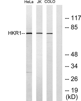 HKR1 rabbit pAb Antibody