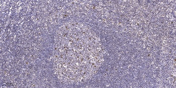 HKR1 rabbit pAb Antibody