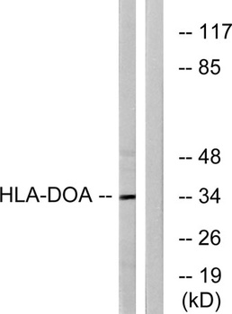 HLA-DOα rabbit pAb Antibody