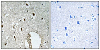 HLX1 rabbit pAb Antibody