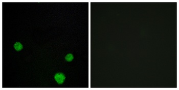 HLX1 rabbit pAb Antibody
