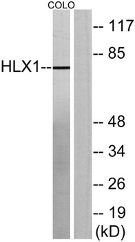 HLX1 rabbit pAb Antibody