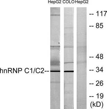 hnRNP C1/C2 rabbit pAb Antibody