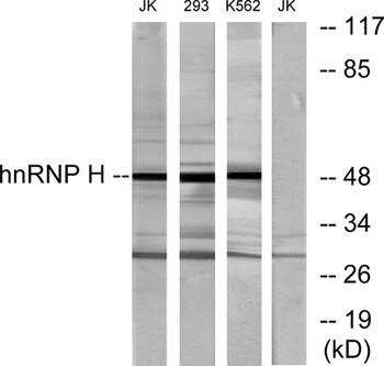 hnRNP H rabbit pAb Antibody