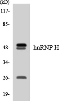 hnRNP H rabbit pAb Antibody