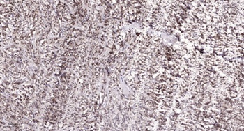 hnRNP H rabbit pAb Antibody