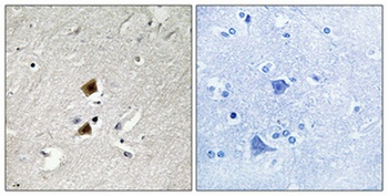 hnRNP LL rabbit pAb Antibody