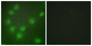 HoxA11/D11 rabbit pAb Antibody