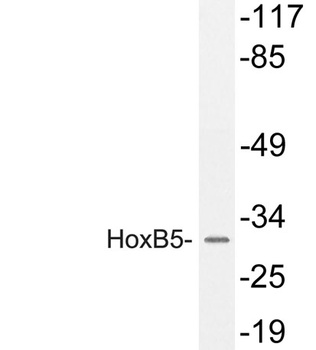 HoxB5 rabbit pAb Antibody