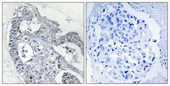 HoxD12 rabbit pAb Antibody