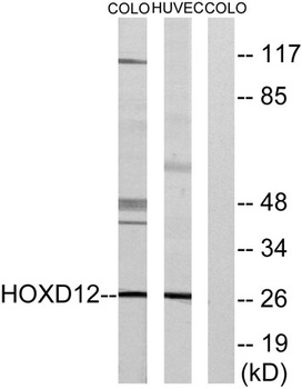HoxD12 rabbit pAb Antibody