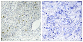 HPK1 rabbit pAb Antibody