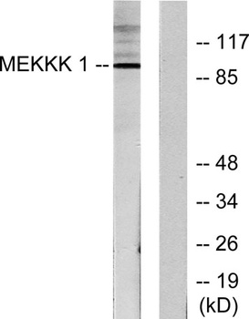 HPK1 rabbit pAb Antibody