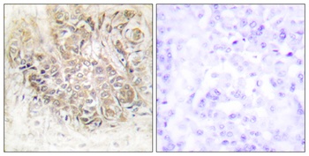 HRF rabbit pAb Antibody