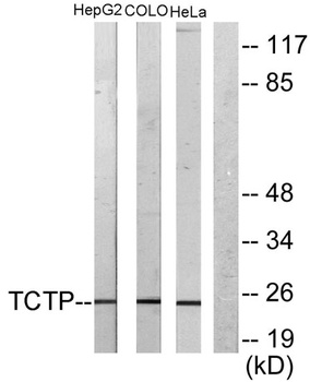 HRF rabbit pAb Antibody