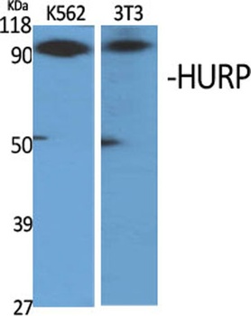 HURP rabbit pAb Antibody
