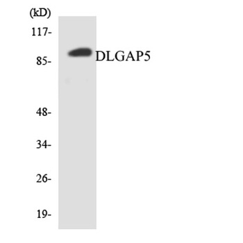 HURP rabbit pAb Antibody