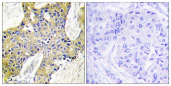 IARS2 rabbit pAb Antibody