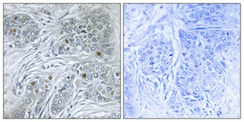 Id4 rabbit pAb Antibody
