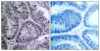 IKKα rabbit pAb Antibody