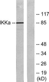 IKKα rabbit pAb Antibody